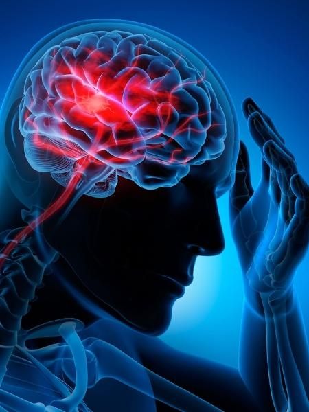 İnme Öncesinde Vücudun Verebileceği Uyarı Sinyalleri... Bu Belirtileri Asla Görmezden Gelmeyin