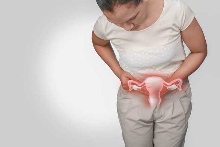 Polikistik Over Sendromu (PCOS) Nedir? Belirtileri, Nedenleri ve Tedavi Yöntemleri